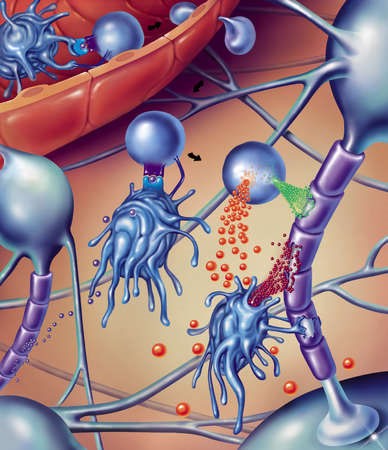 Использование стволовых клеток человека при рассеянном склерозе